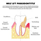 ATTDX GumErleichterung ParodontalBehandlung Gel