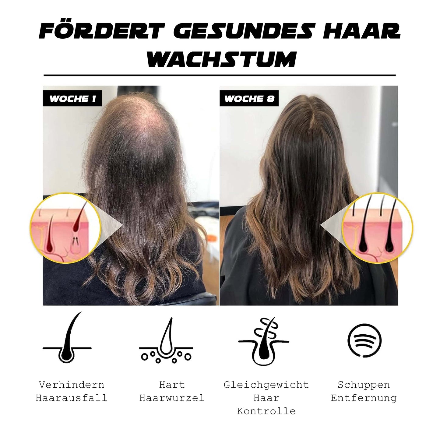 ATTDX Haare Follikel Erneuerung Schwarz Sesam Kugel