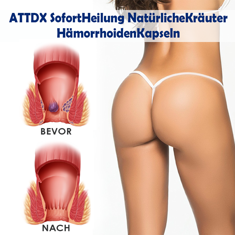 ATTDX SofortHeilung NatürlicheKräuter HämorrhoidenKapseln