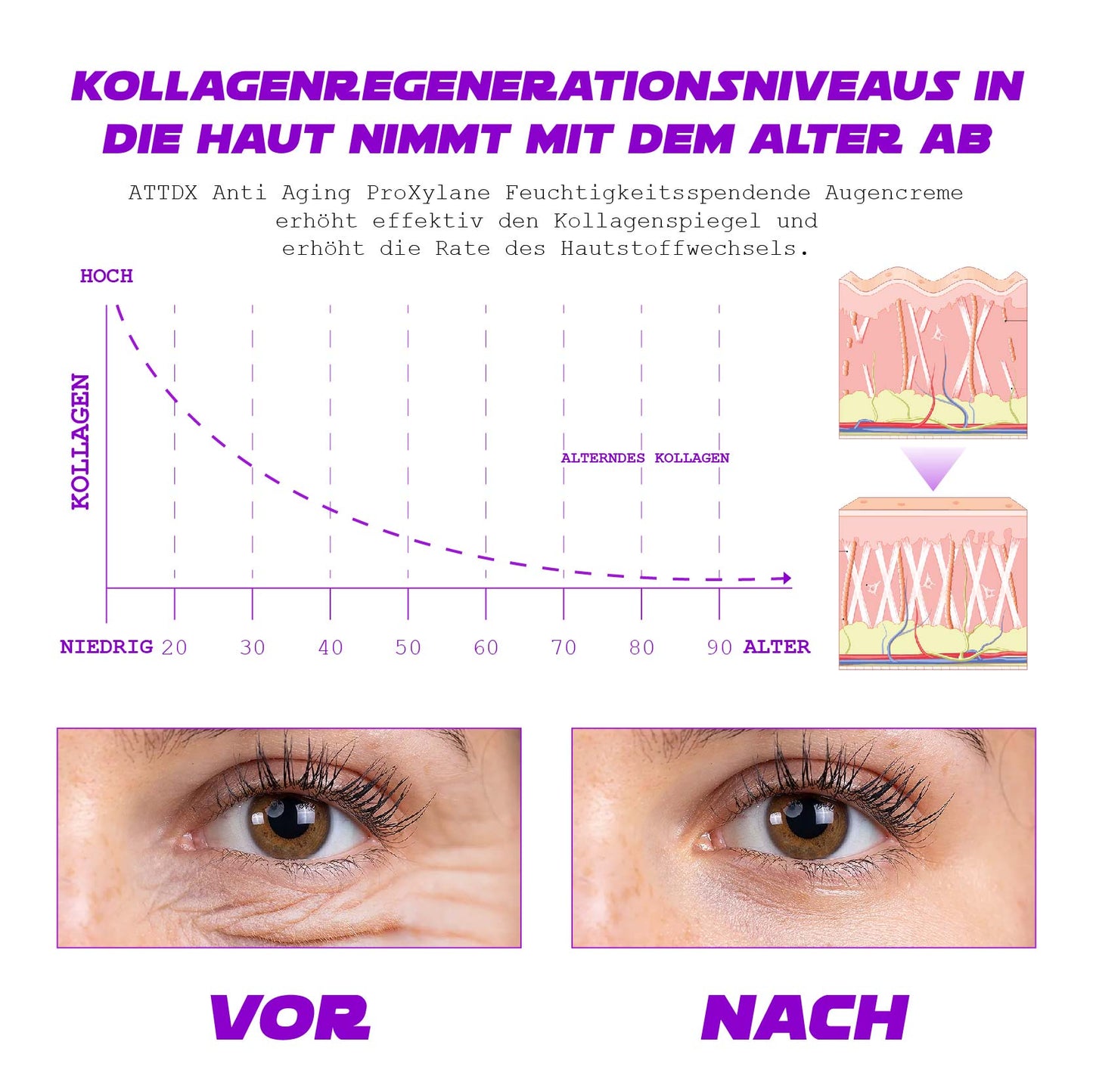 ATTDX AntiAltern ProfiXylan Feuchtigkeitsspendend AugeCreme