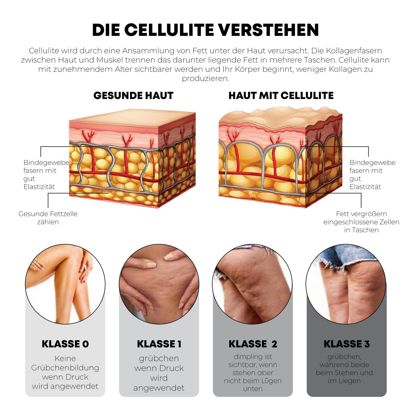 ATTDX KörperSchlank Verschärfung Gel