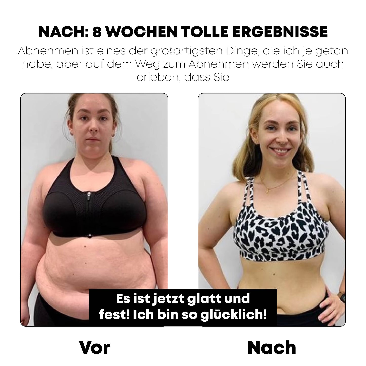 ATTDX KörperSchlank Verschärfung Gel