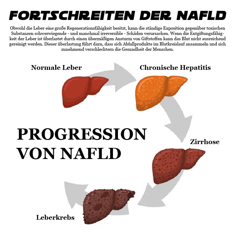 ATTDX SofortErleichterung Kräuter LeberHeilung Tropfen