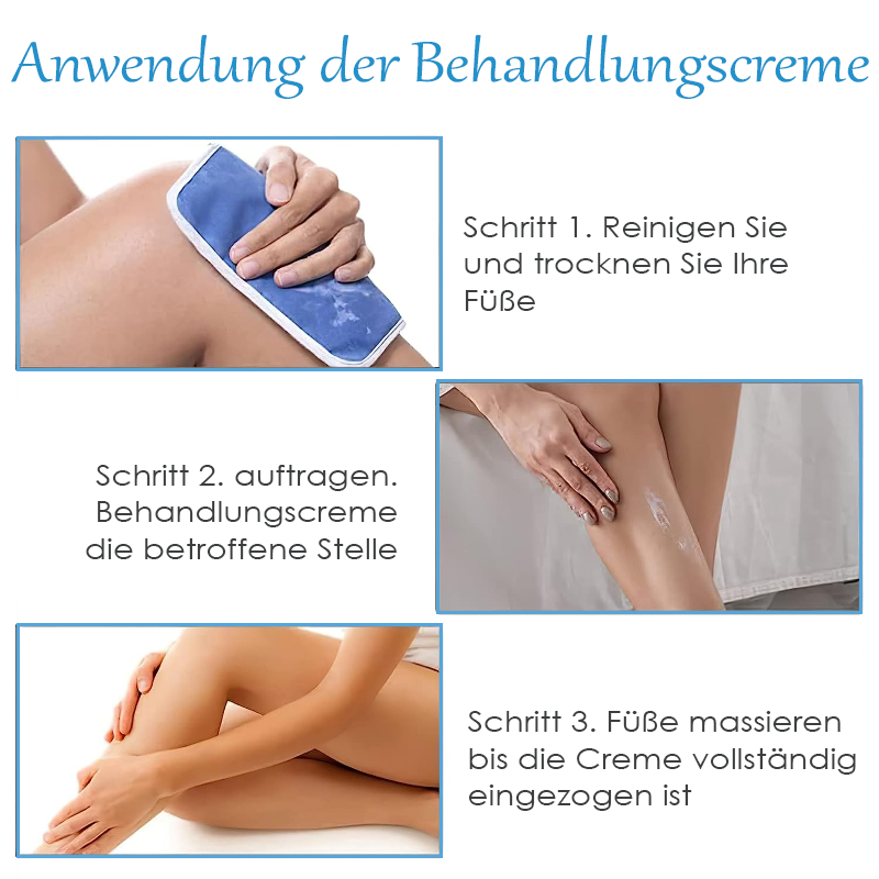 ATTDX Krampfadern SpinneVene Behandlung Creme