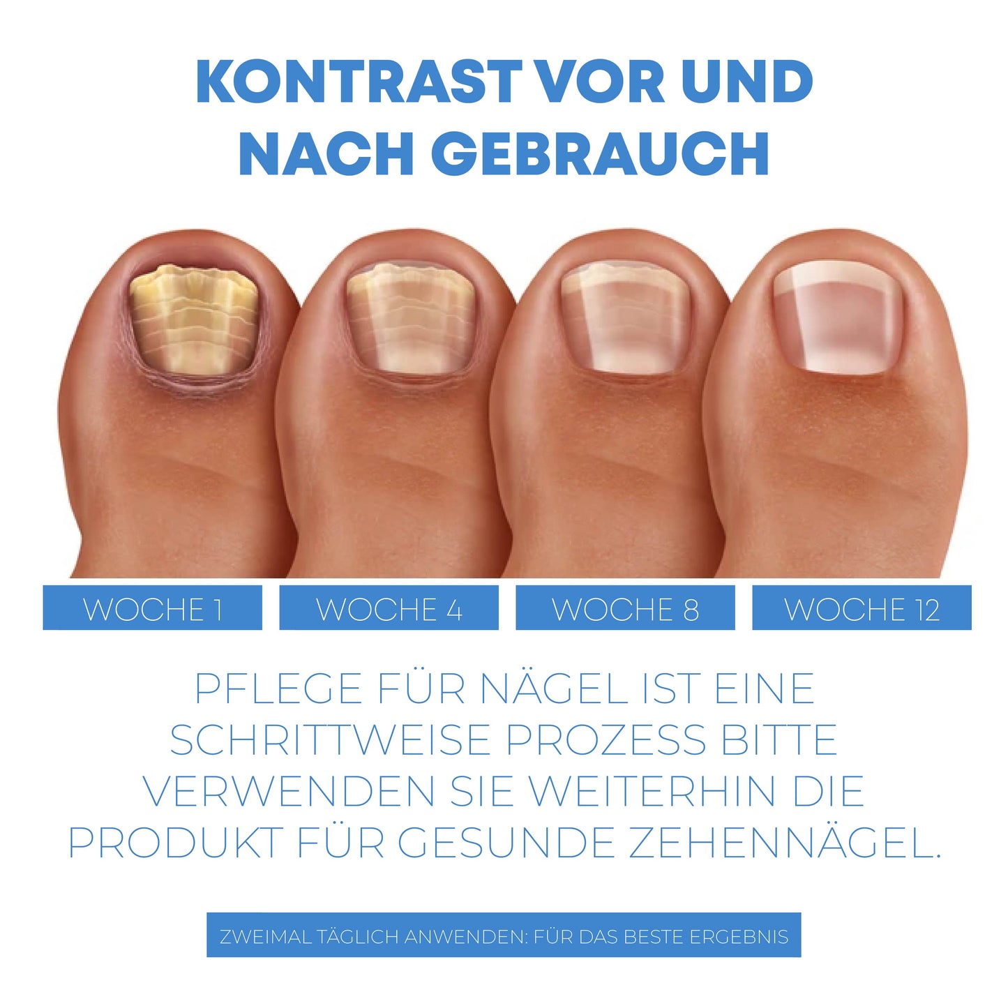 ATTDX NagelReparaturFeuchtigkeitscreme Behandlung Aufnäher