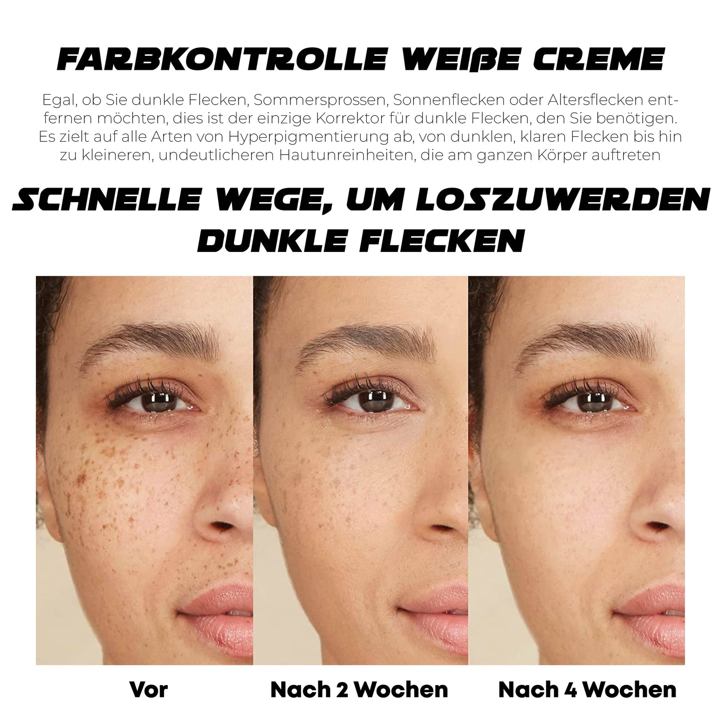 ATTDX PigmentEntfernung Probiotisch Lichtschutzfaktor 50 TagCreme