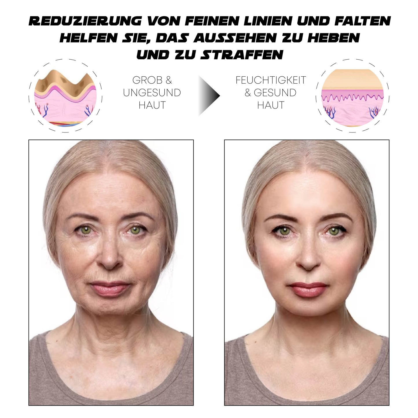 ATTDX PigmentEntfernung Probiotisch Lichtschutzfaktor 50 TagCreme