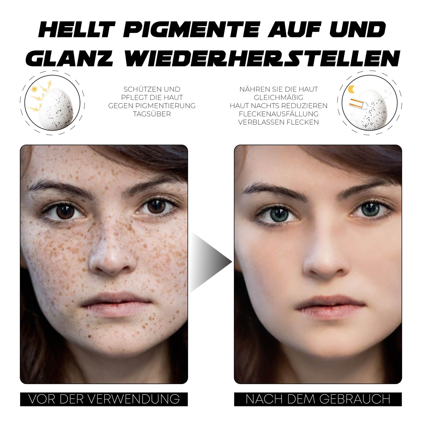 ATTDX PigmentEntfernung Probiotisch Lichtschutzfaktor 50 TagCreme