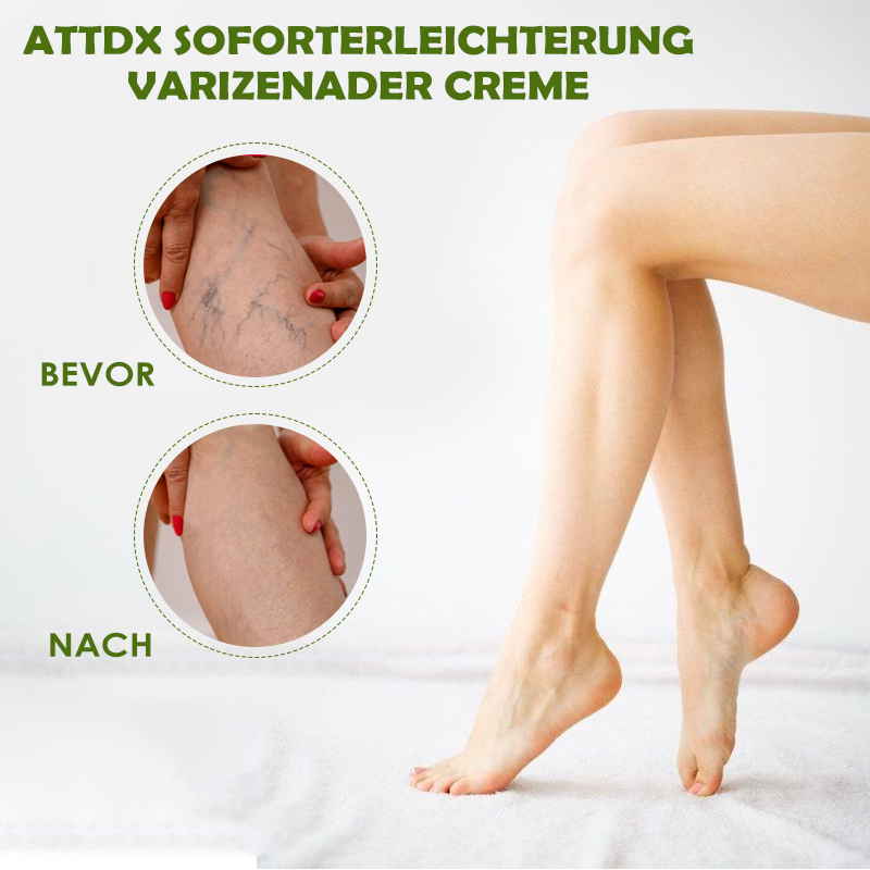 ATTDX SofortErleichterung VarizenAder Creme