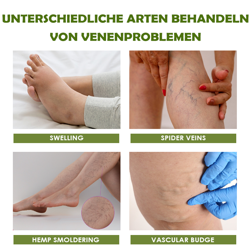 ATTDX SofortErleichterung VarizenAder Creme