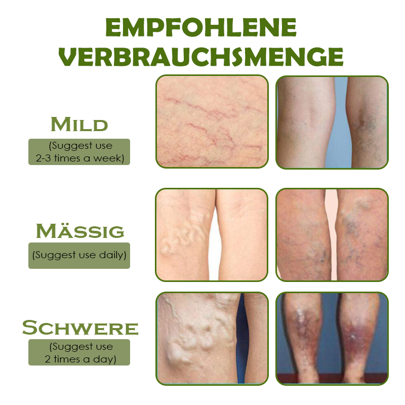 ATTDX SofortErleichterung VarizenAder Creme