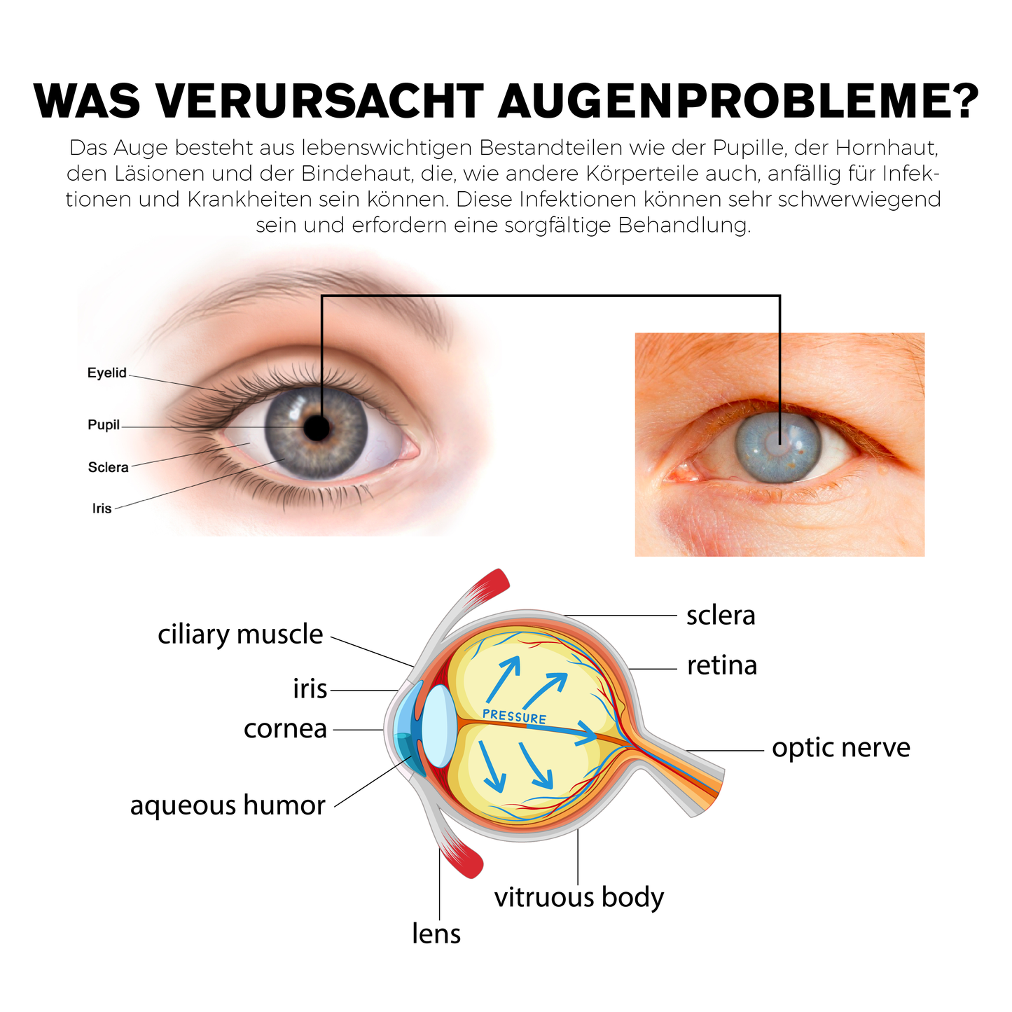 ATTDX Behandlung AugenProbleme LösungsTropfen