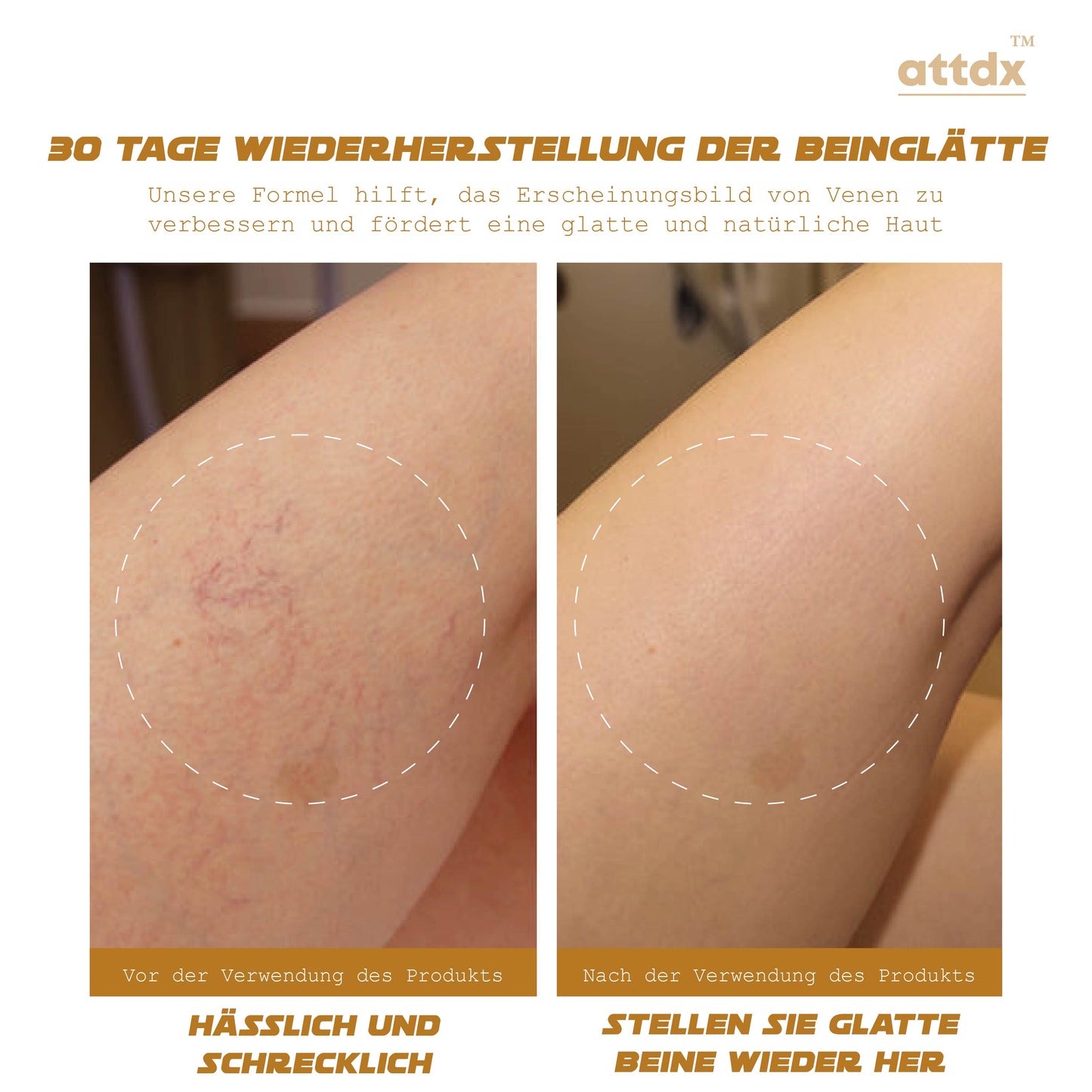 ATTDX VenenErneuerung GlatteBeine Crème