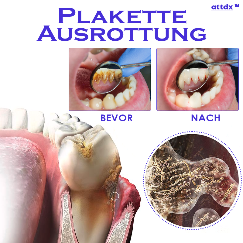 ATTDX ZähneAufhellung OralReinigung Essenz