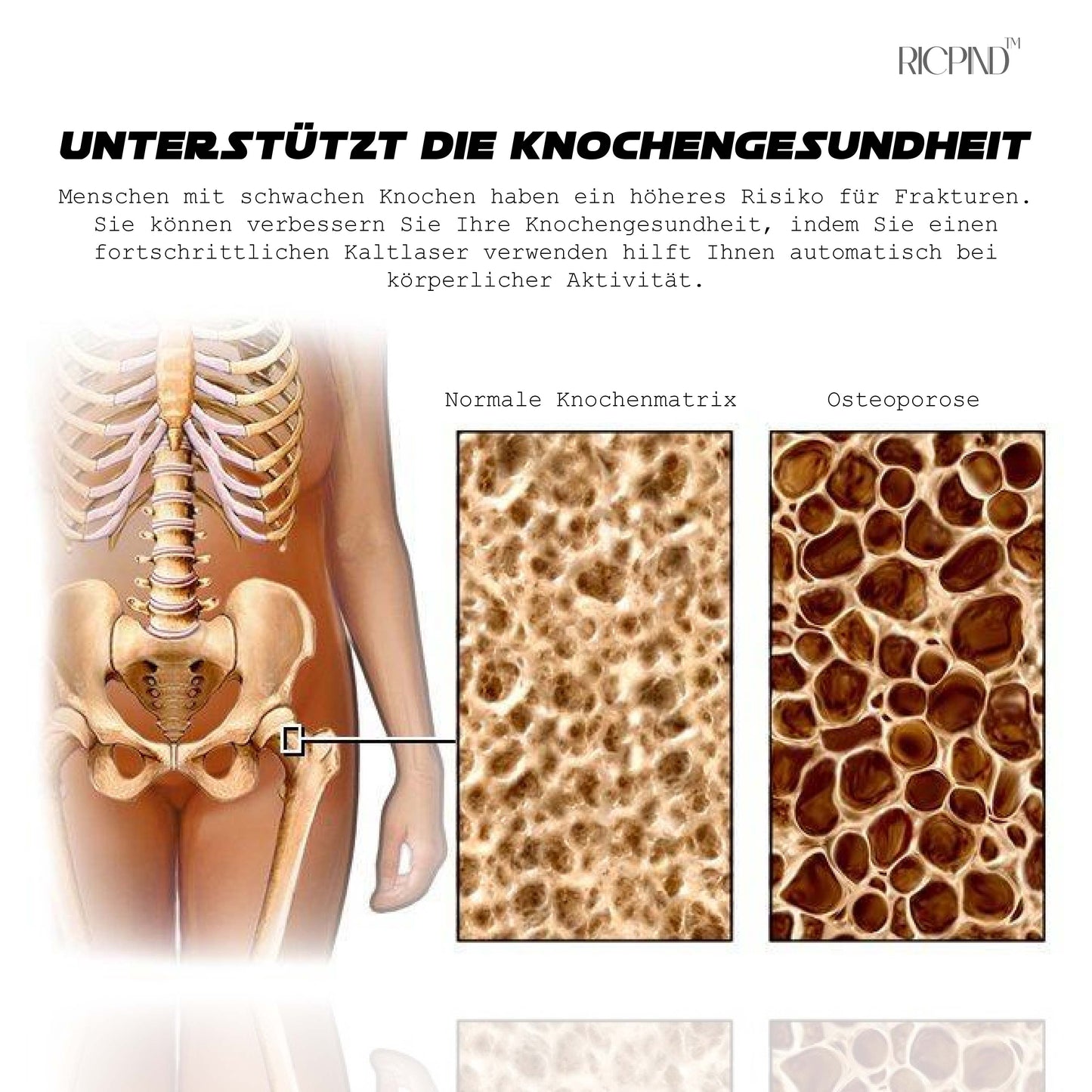 RICPIND Ultimativ Kaltlaser ThermaHeilung Entlastungsvorrichtung