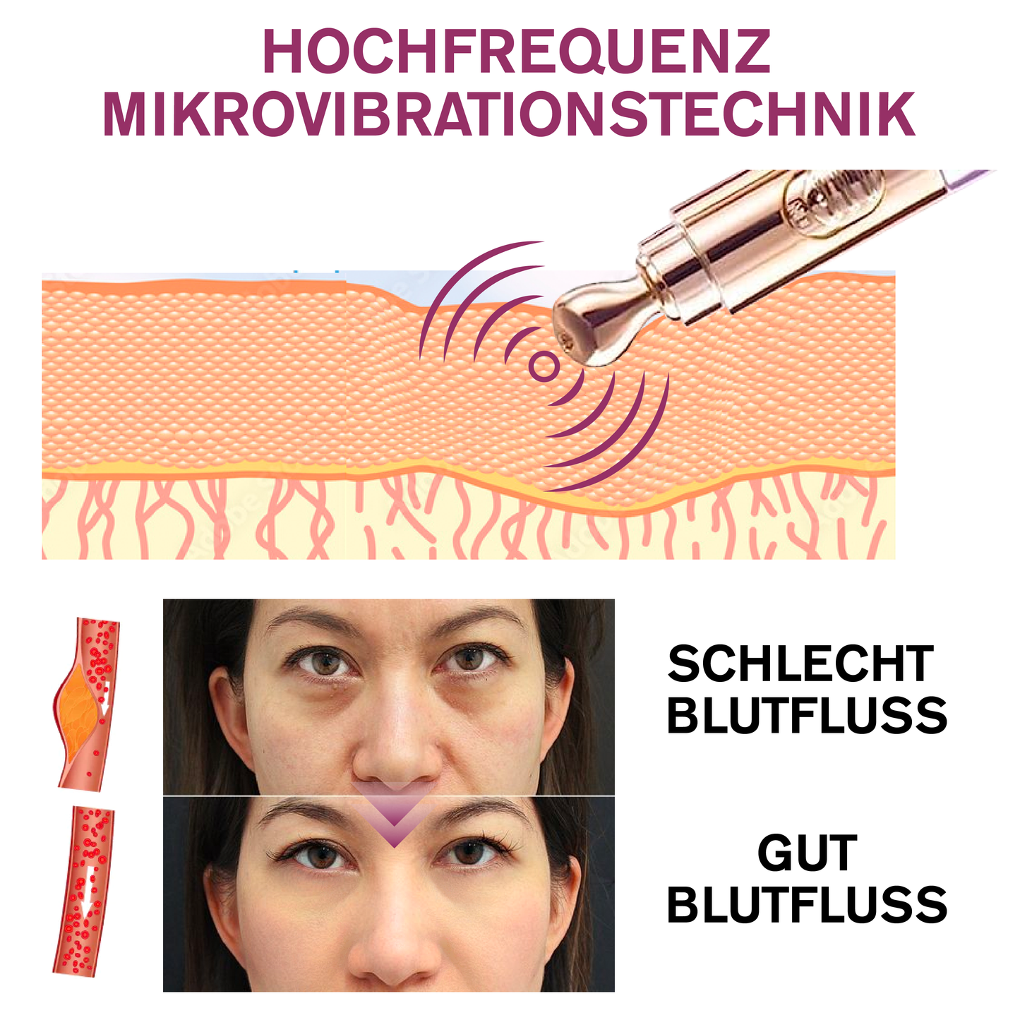 ATTDX MilchFlecken Behandlung ElektrischSerum Stift