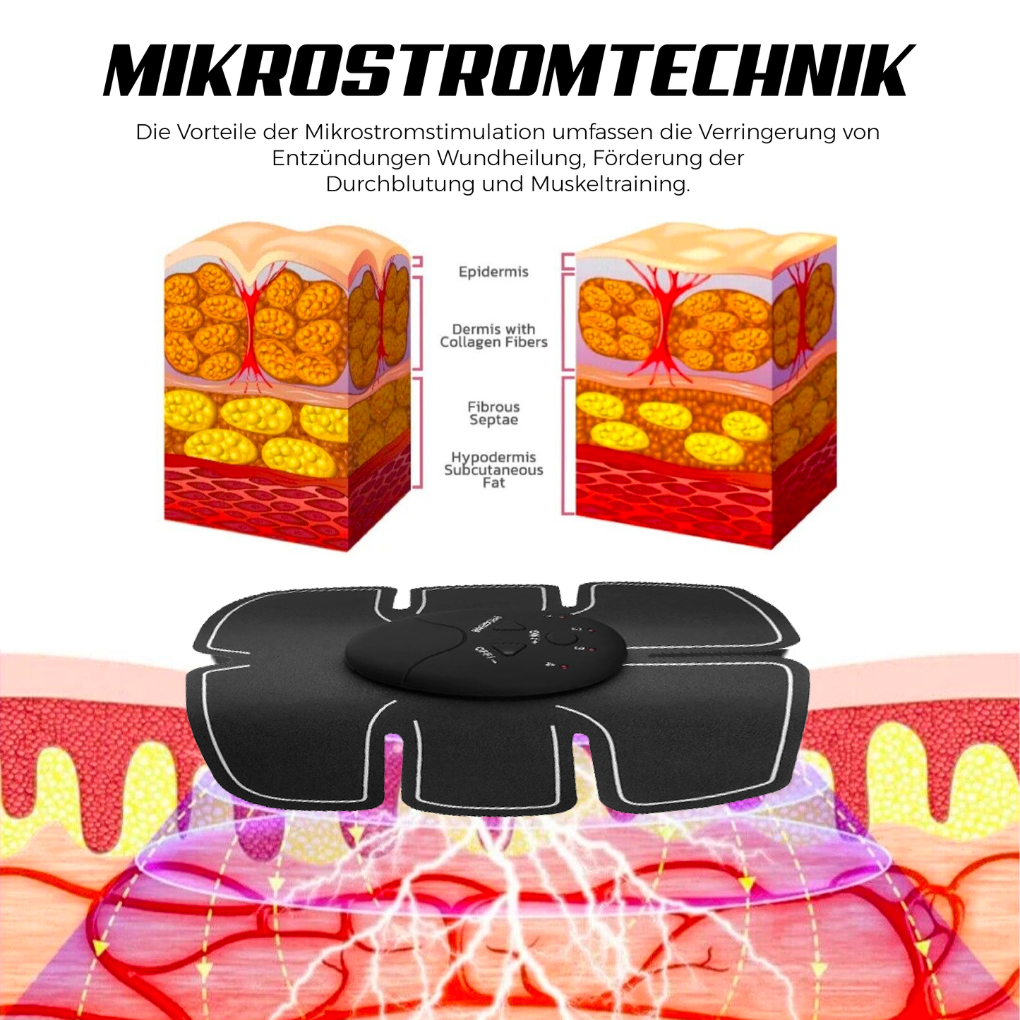 Ricpind EMS AbsStraffung Muskeln Stimulator