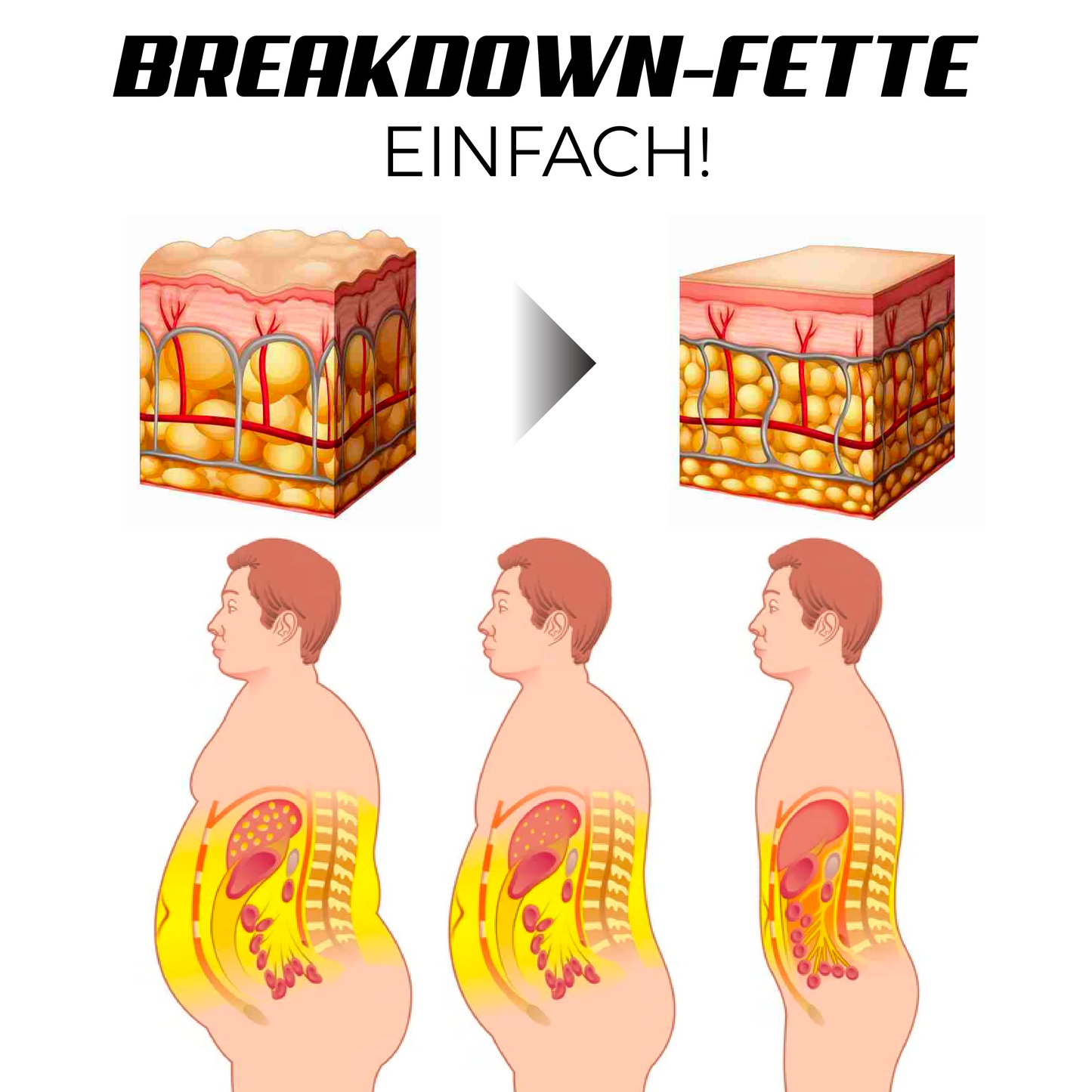 Ricpind EMS AbsStraffung Muskeln Stimulator