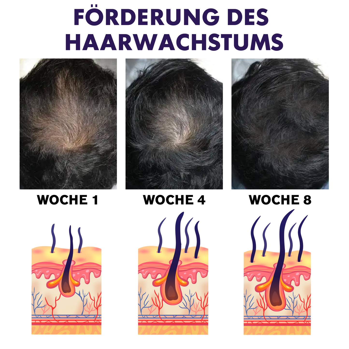 ATTDX HaarNachwachsen Ginseng Shampoo Bar