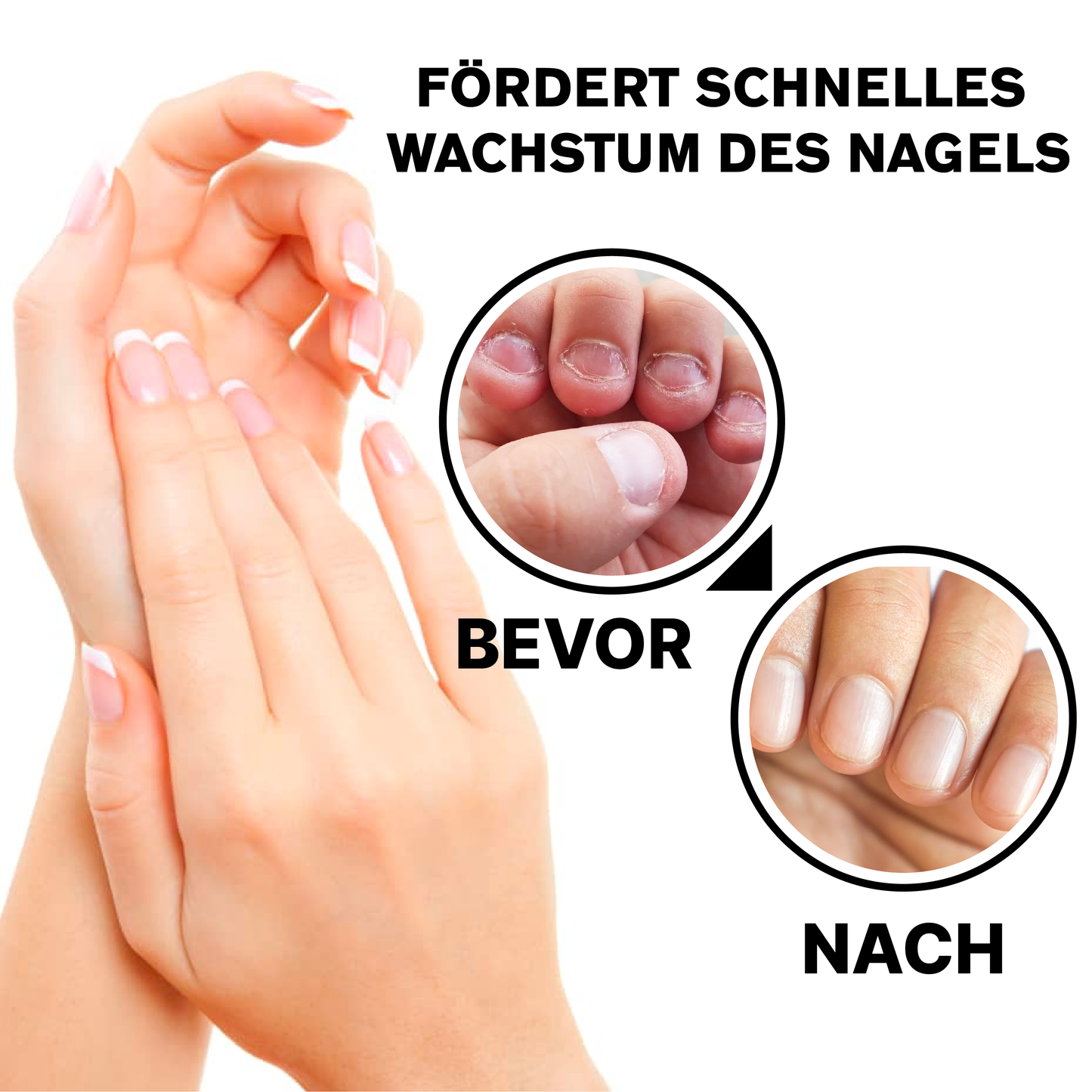 ATTDX NagelReparatur Wachstum Feuchtigkeitsspendend Serum