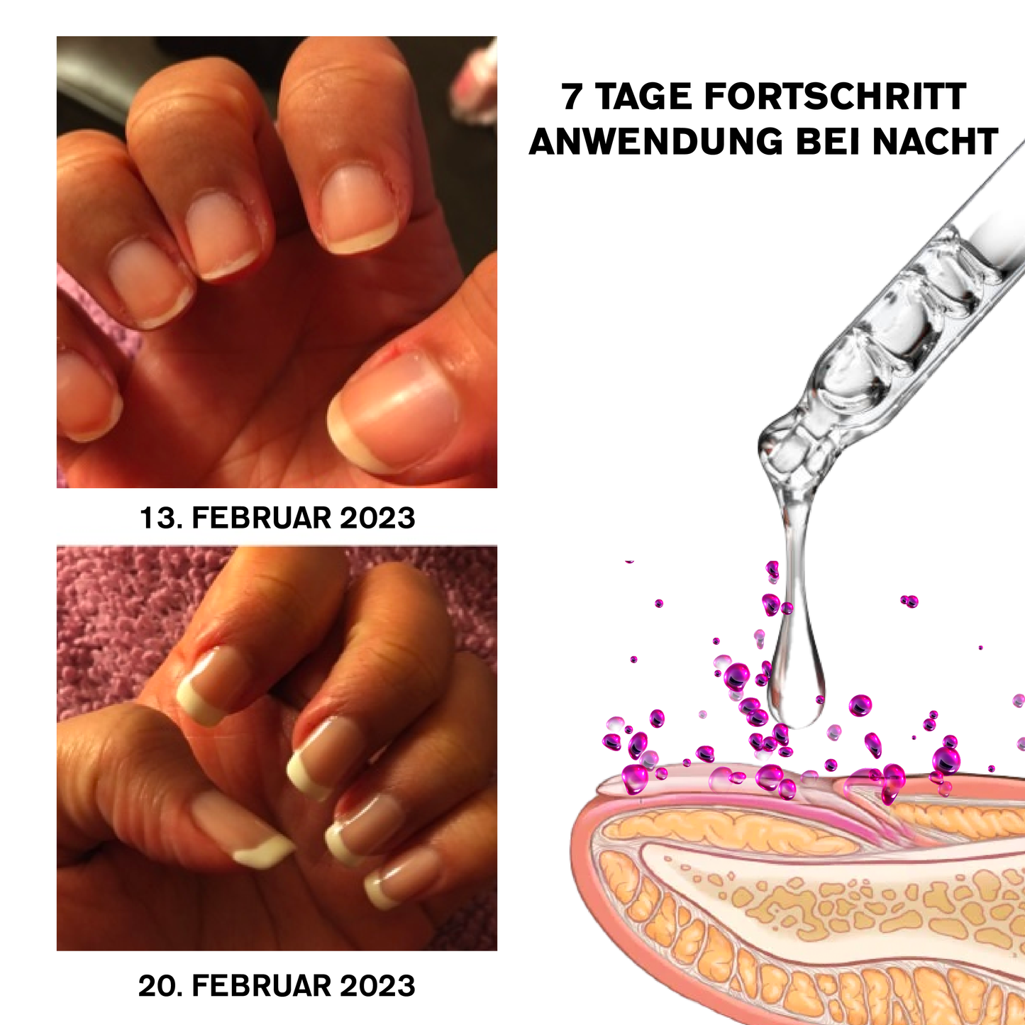 ATTDX NagelReparatur Wachstum Feuchtigkeitsspendend Serum