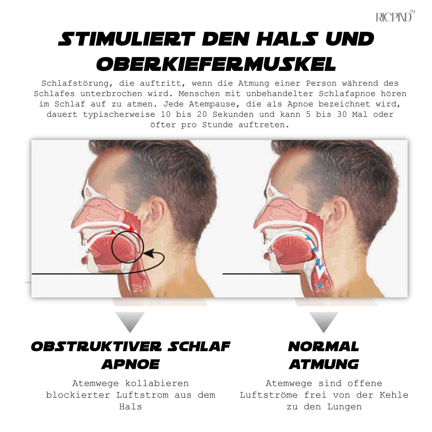 Ricpind AI Vibrationsstopper zur sofortigen Schnarchreduzierung