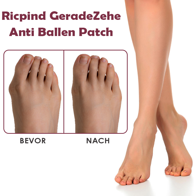 Ricpind GeradeZehe Anti Ballen Patch