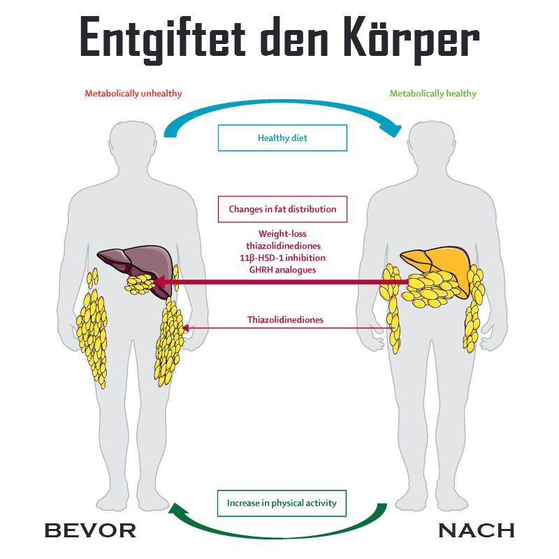 Ricpind IonischPro Männer KörperAbnehmen EnergieFeld Kurz