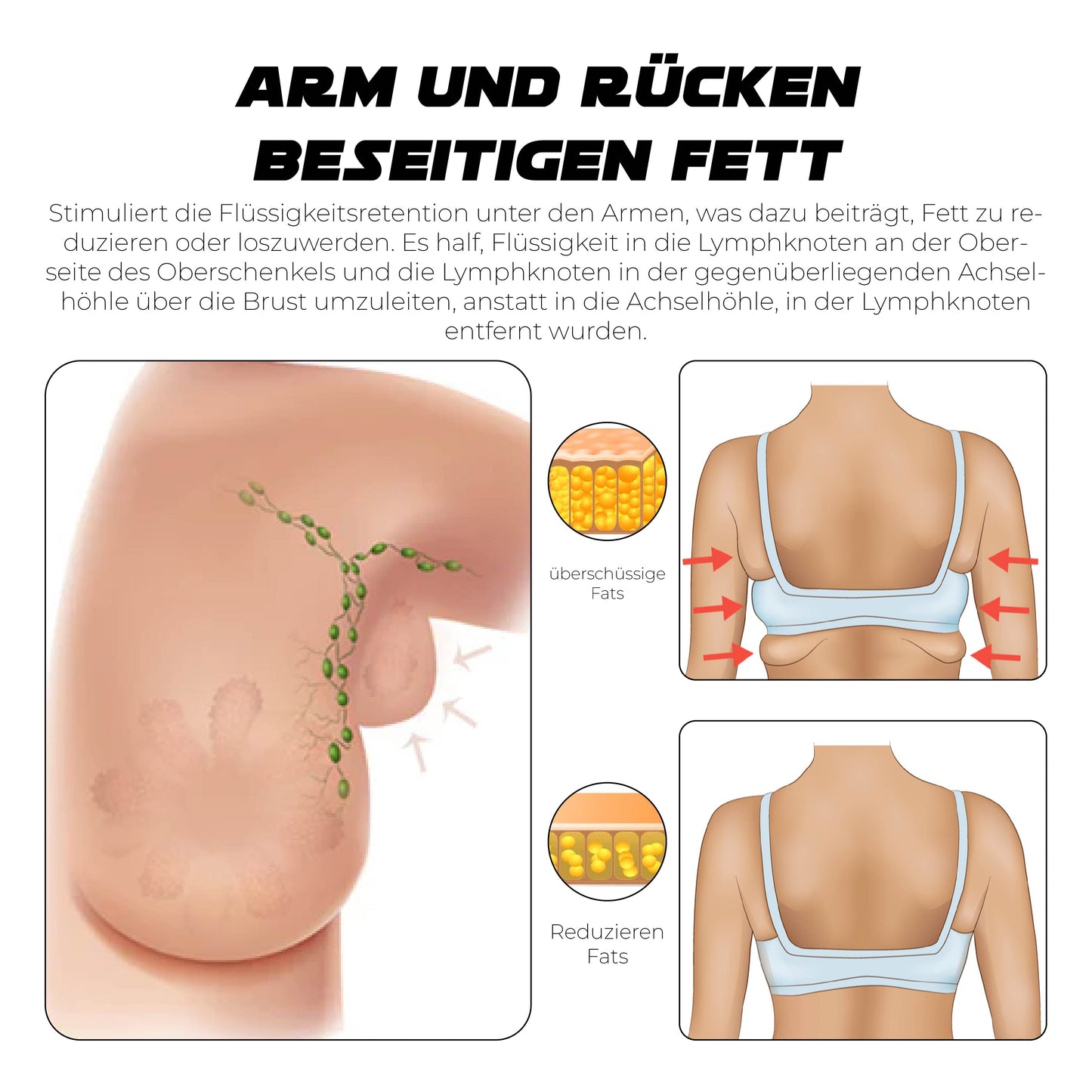 Ricpind Lymphvity Drahtlos Liegestütz Bra