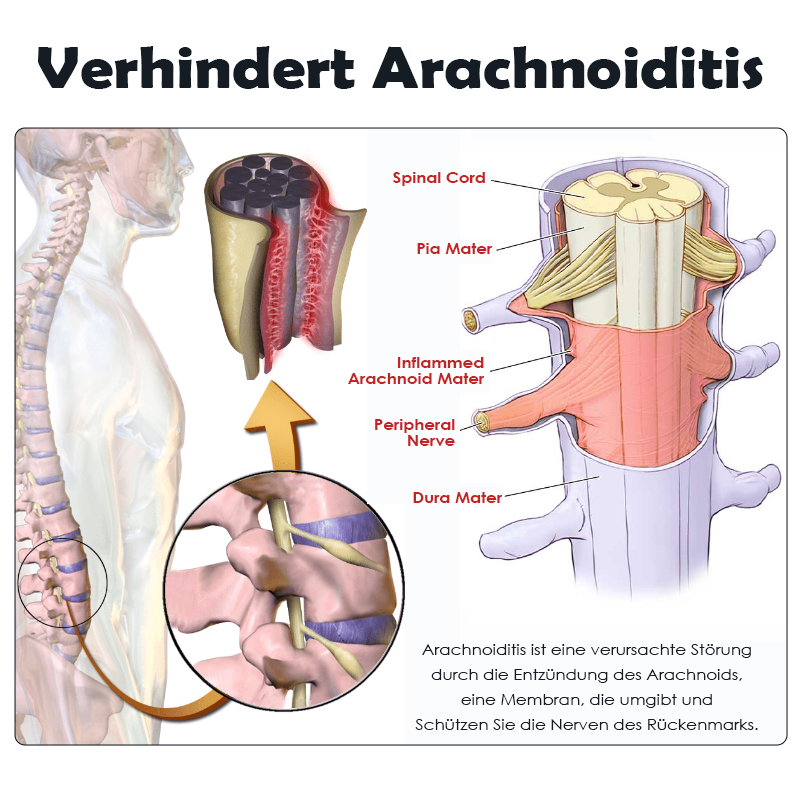 Ricpind SchmerzErleichterung IschiasTherapeutisch Kompression Gürtel