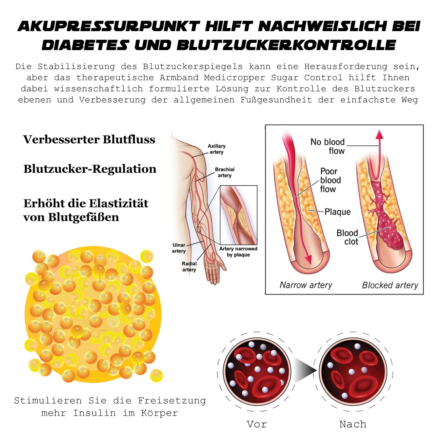 Ricpind Ultraschall ZuckerKontrolle Intelligent Fitband